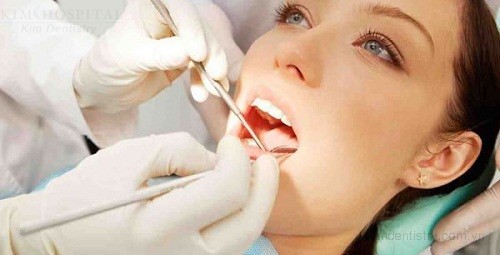 Tái khám sau khi thực hiện cấy ghép implant cũng là một trong những cách kéo dài tuổi thọ của răng implant